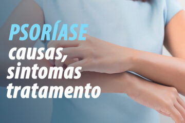 Psoríase: causas, sintomas, tratamento